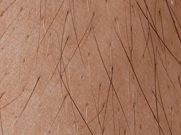 Skin texture (ID:ffagg99568)