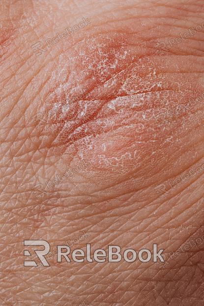 Skin texture