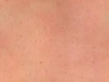 Skin texture (ID:ffach340974)