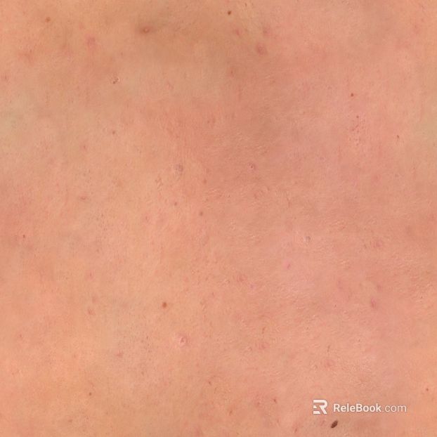 Skin texture