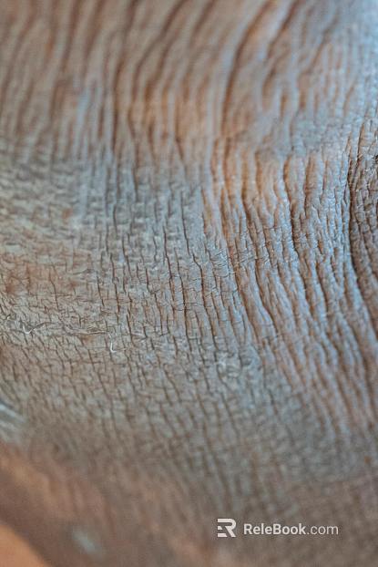 Skin texture
