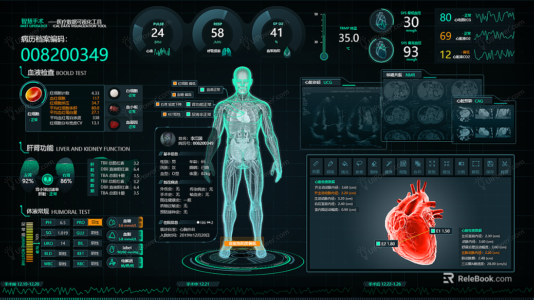 Screen material texture