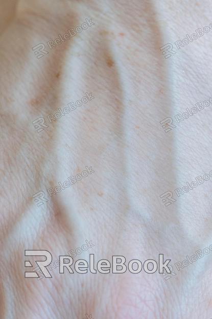 Skin texture