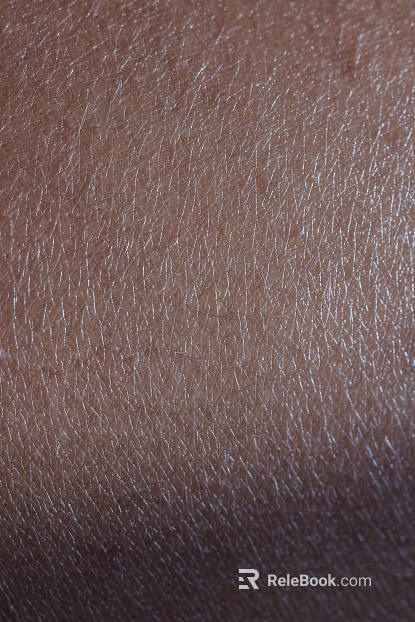 Skin texture