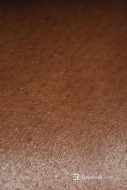 Skin texture
