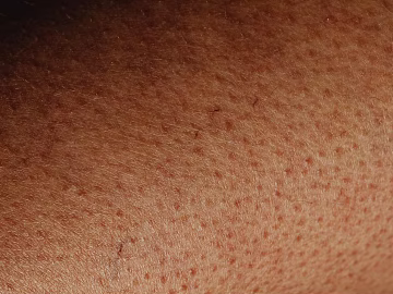 Skin texture (ID:ffagg14243)
