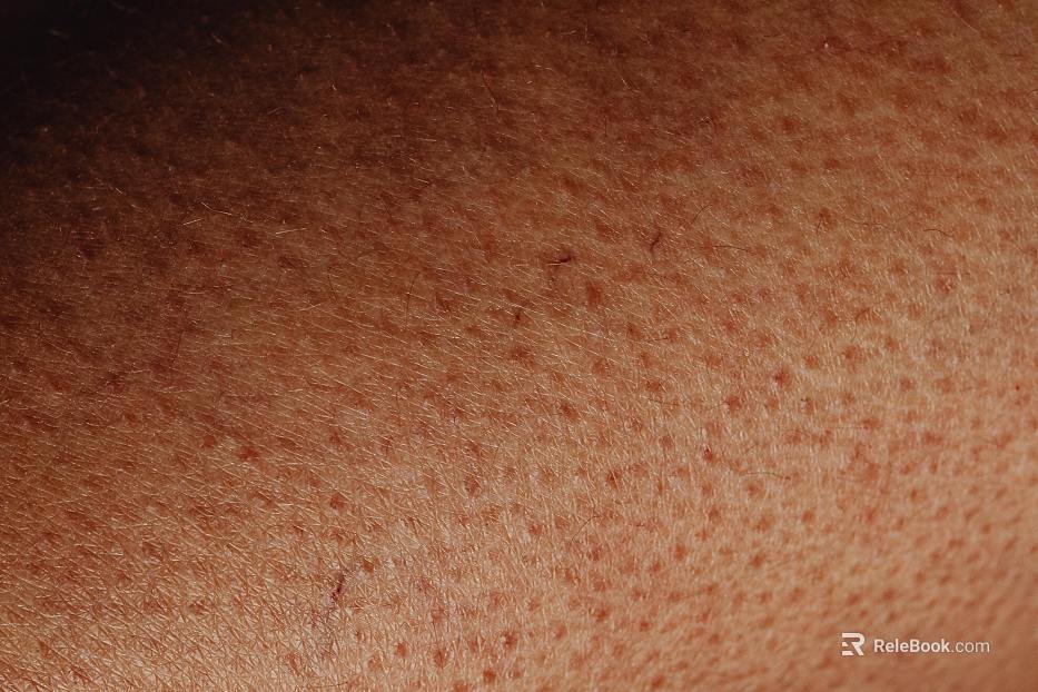Skin texture