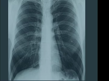 X-ray texture (ID:ffagg05063)