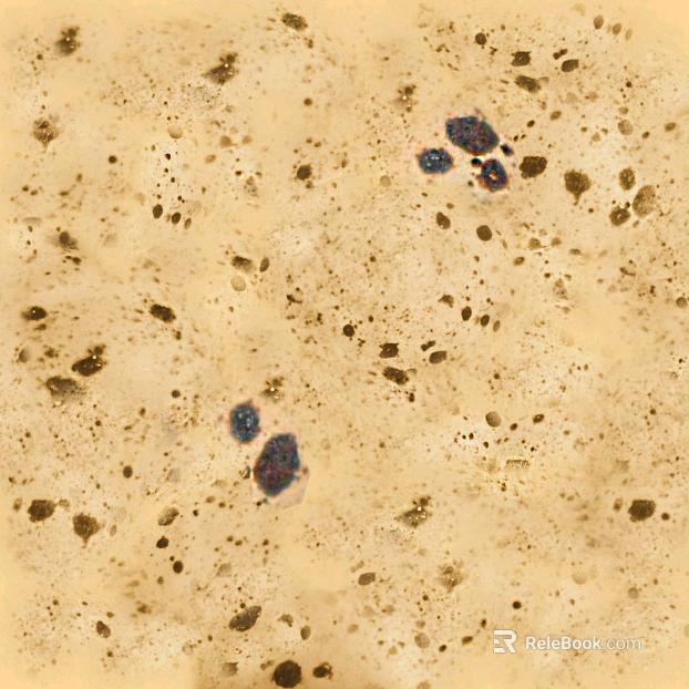 Dongshi texture