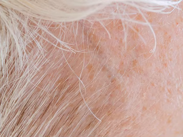 Skin texture (ID:ffagg91953)